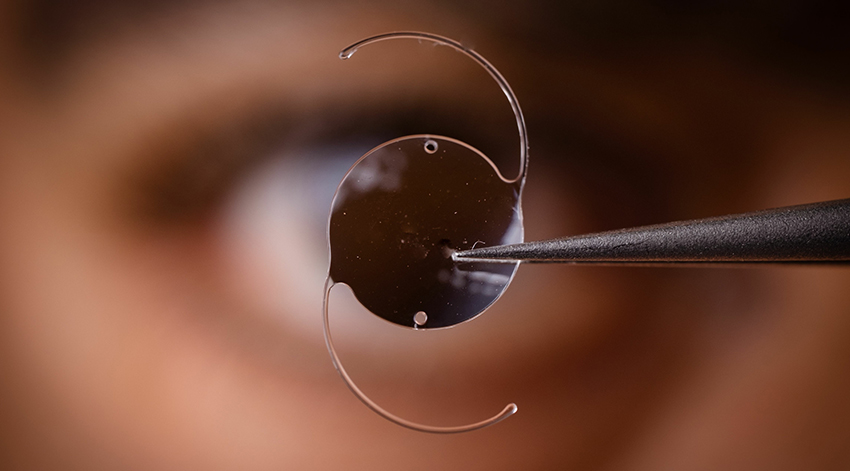 PCIOLS Implantble Lenses for your eyes offered in Jacksonville FL